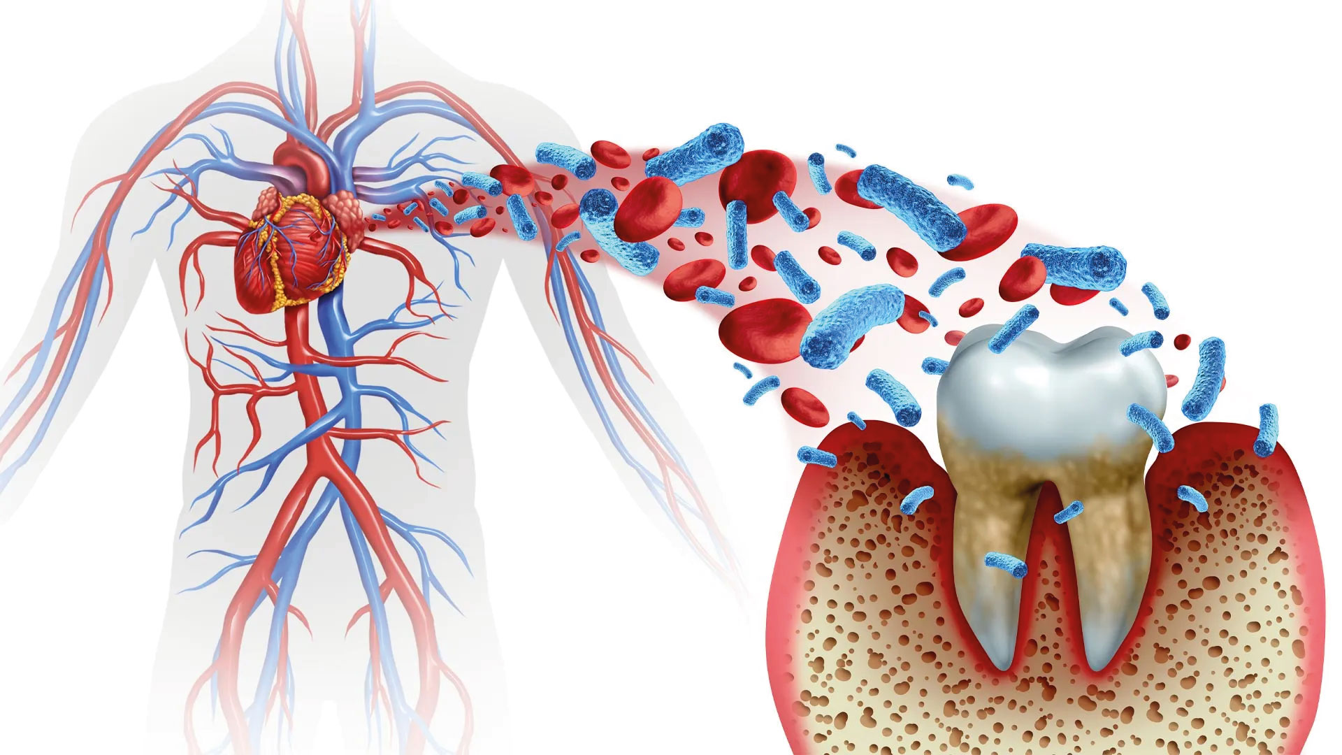 The Surprising Link Between Gum Health and Your Heart